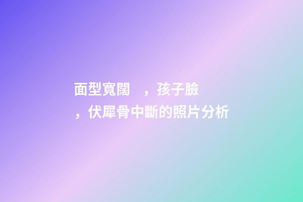 面型寬闊，孩子臉，伏犀骨中斷的照片分析